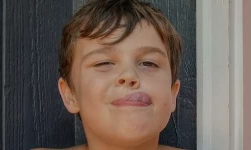 коротка вуздечка язика